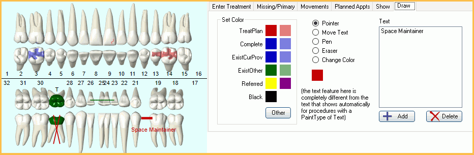 Open Dental Charting