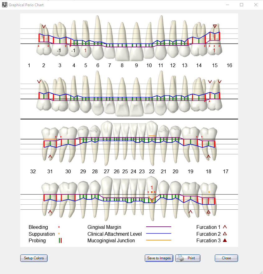 Manual Charting In Dentistry