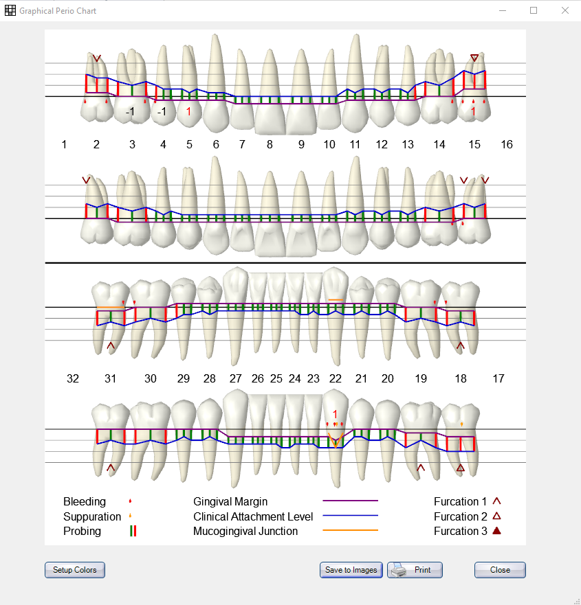 Periodontal Charting Software