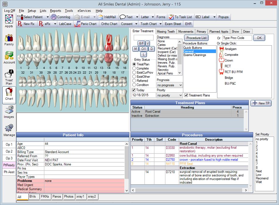 Open Dental Charting