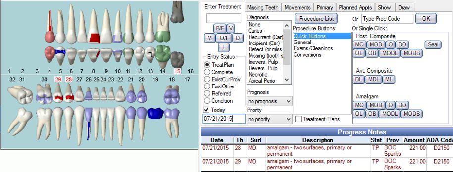 Open Dental Charting