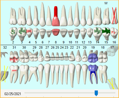 Canadian Dental Tooth Chart