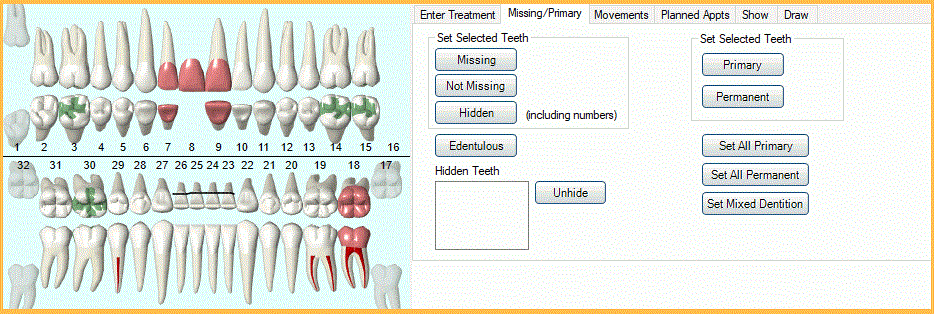 How To Do Dental Charting