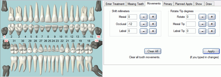 Tooth Chart 1 32
