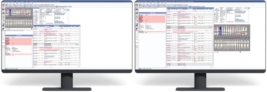 Open Dental Software - Chart Layout